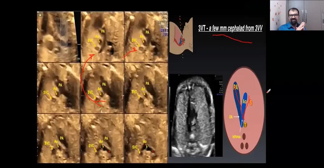 Fetal Echocardiography Training Course: Expert Cardiac Imaging