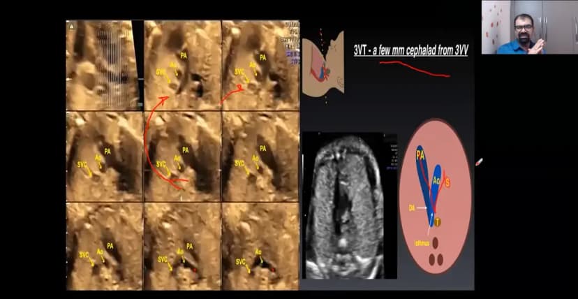 Fetal Echocardiography Training Course: Expert Cardiac Imaging