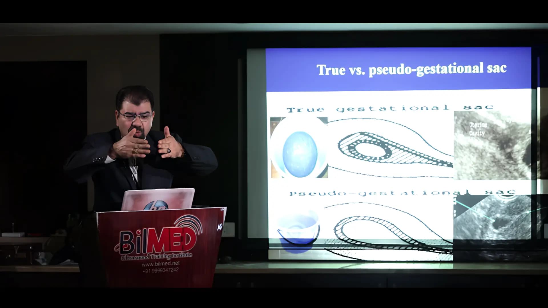 Early Pregnancy Ultrasound Training: Ectopic & Level-1
